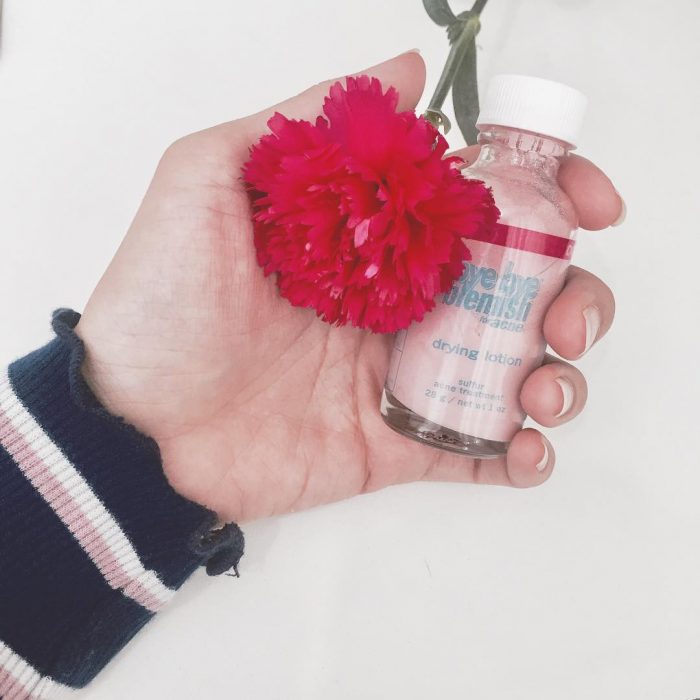 ssdh-bye-bye-blemish-acne-drying-lotion